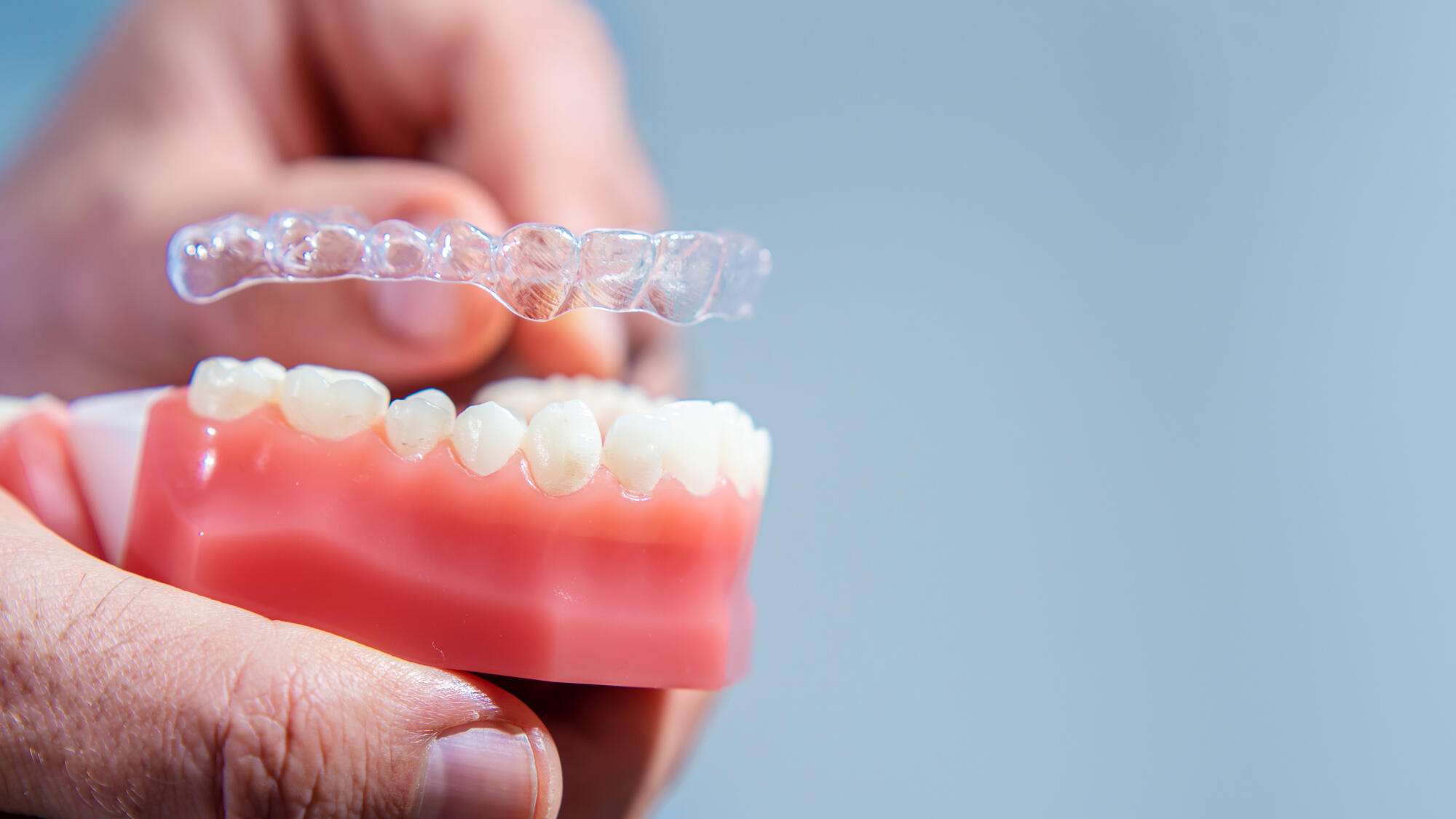 Confidence at every age: Clear aligners are redefining orthodontics