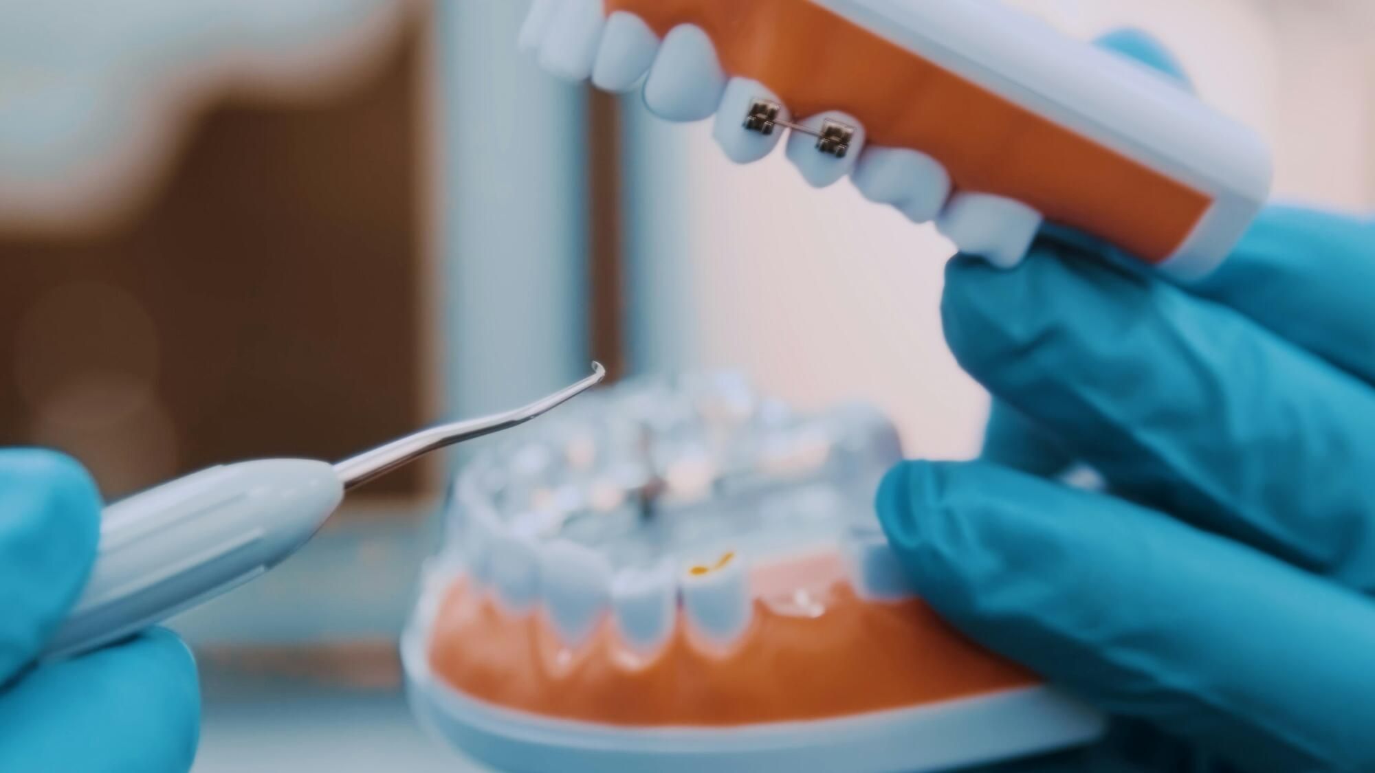 The untold story of Mike Tyson's teeth transformation